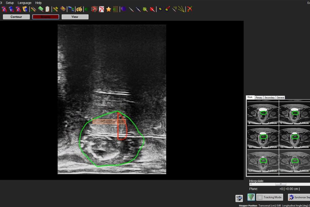 urologie-mainz-Fusionsbiopsie Fritsch (1)