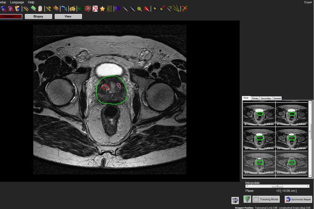 urologie-mainz-Fusionsbiopsie Fritsch